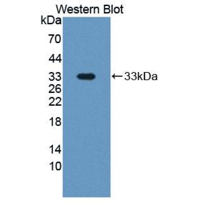 Pregnancy Associated Plasma Protein A (PAPPA) Human Polyclonal Antibody