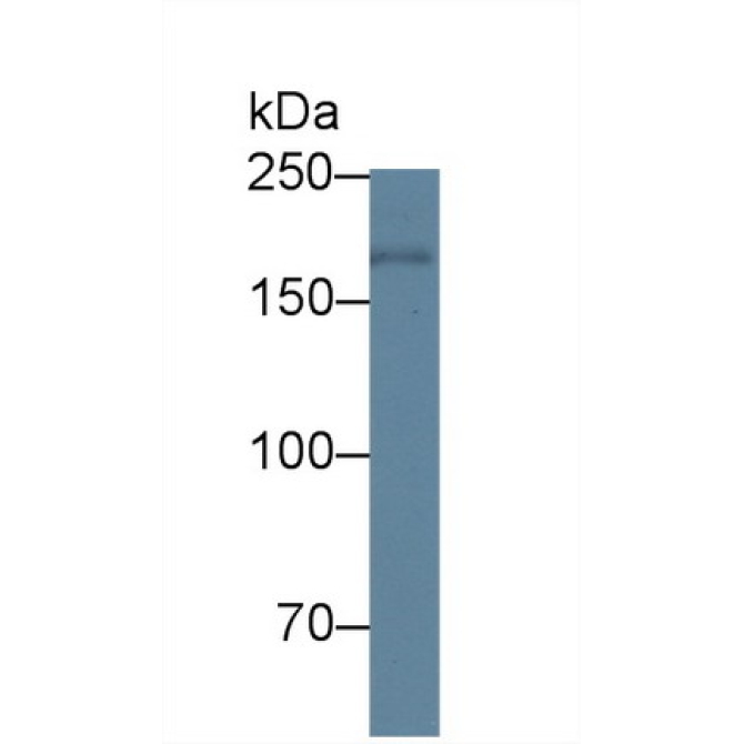 Pregnancy Associated Plasma Protein A (PAPPA) Human Polyclonal Antibody