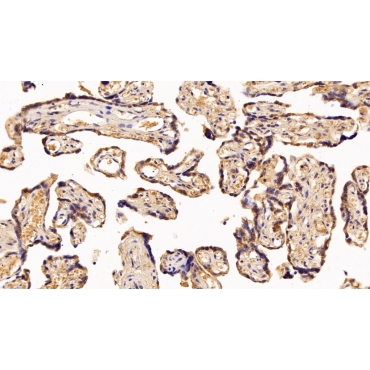 Pregnancy Associated Plasma Protein A (PAPPA) Mouse Polyclonal Antibody