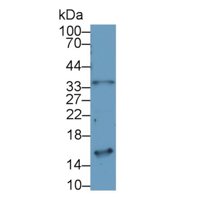 Neuromedin B (NMB) Human Polyclonal Antibody