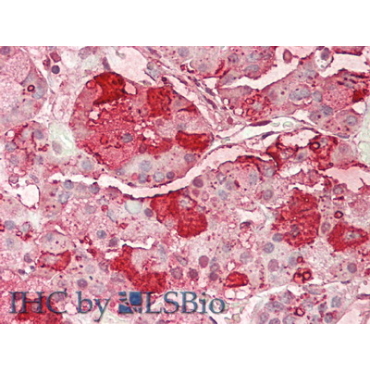 Beta-Endorphin (bEP) Human Polyclonal Antibody