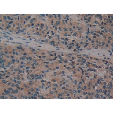 Fucosidase Alpha L1, Tissue (FUCa1) Human Polyclonal Antibody
