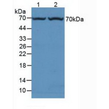 Fucosidase Alpha L1, Tissue (FUCa1) Mouse Polyclonal Antibody