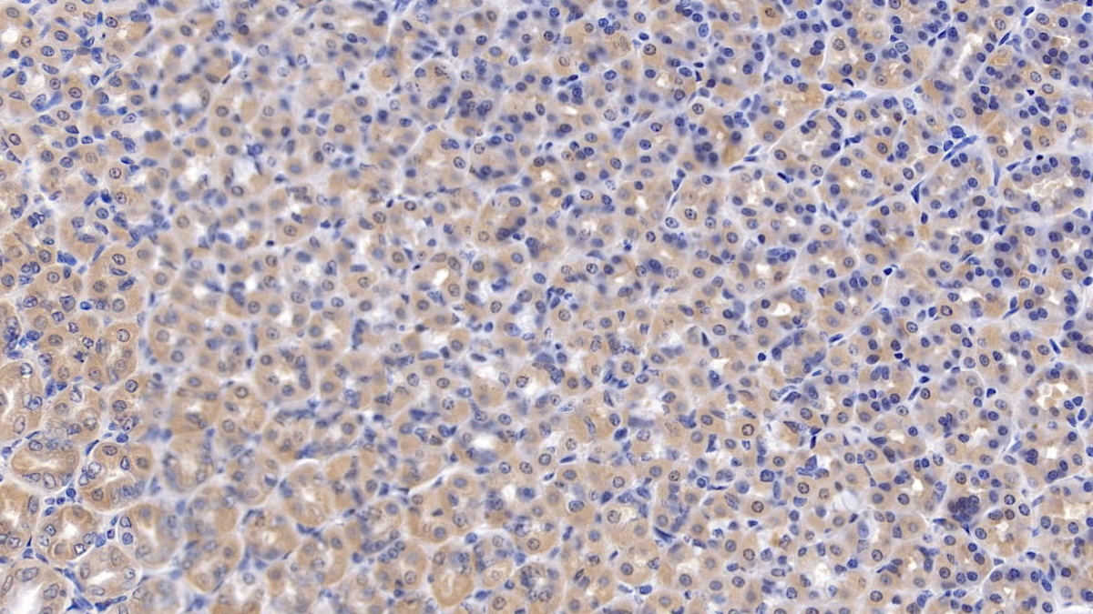 Fucosidase Alpha L1, Tissue (FUCa1) Rat Polyclonal Antibody