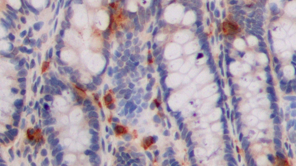 5-Hydroxytryptamine (5-HT) Pan-species (General) Polyclonal Antibody