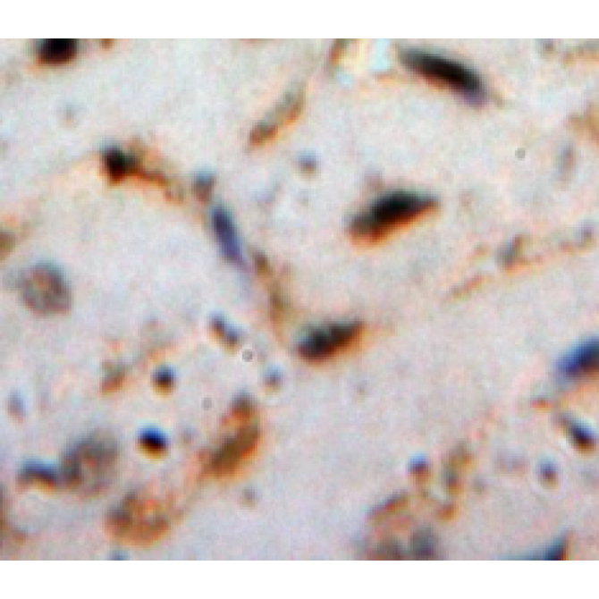 Cardiotrophin 1 (CT1) Human Polyclonal Antibody