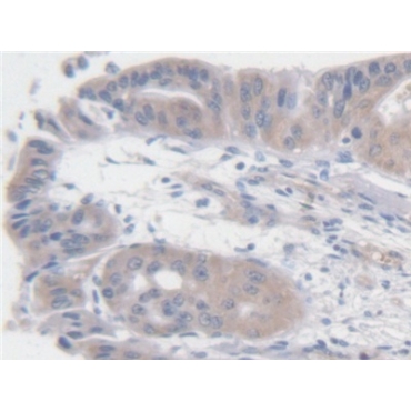 Angiotensin I (AngI) Human Polyclonal Antibody