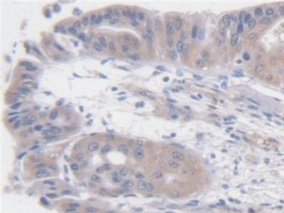Angiotensin I (AngI) Human Polyclonal Antibody