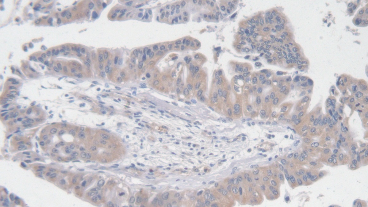 Angiotensin I (AngI) Human Polyclonal Antibody