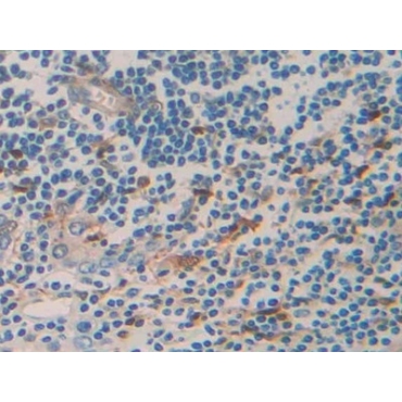 Tumor Necrosis Factor Receptor Superfamily, Member 12A (TNFRSF12A) Human Polyclonal Antibody