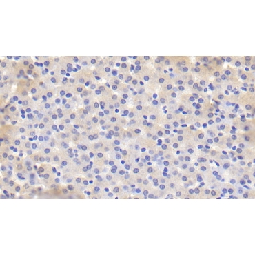 Cholesteryl Ester Transfer Protein (CETP) Human Polyclonal Antibody