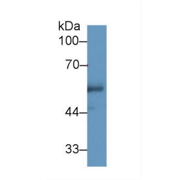 Cholesteryl Ester Transfer Protein (CETP) Human Polyclonal Antibody