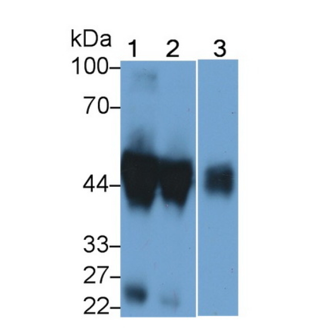 Alpha-1-Acid Glycoprotein (a1AGP) Human Polyclonal Antibody