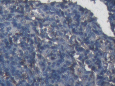 Alpha-1-Acid Glycoprotein (a1AGP) Rabbit Polyclonal Antibody