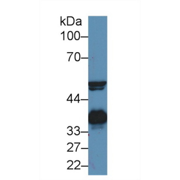 Haptoglobin (Hpt) Bovine (Cattle) Polyclonal Antibody