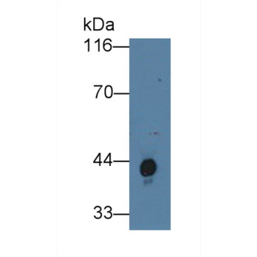 Haptoglobin (Hpt) Human Polyclonal Antibody