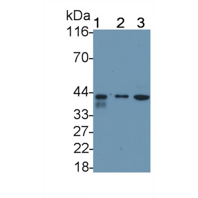 Death receptor 5 (DR5) Human Polyclonal Antibody