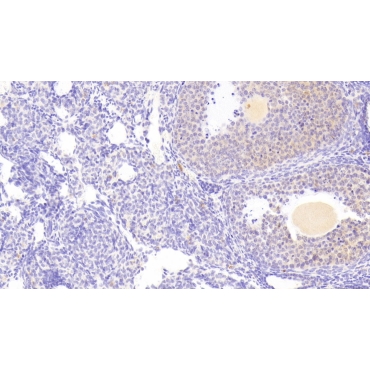 Death receptor 5 (DR5) Mouse Polyclonal Antibody