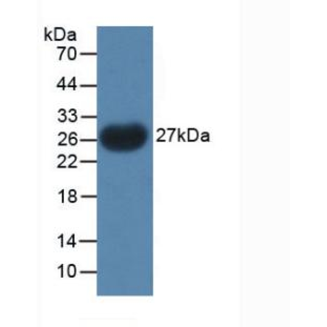 Parathyroid Hormone Related Protein (PTHrP) Chicken (Gallus) Polyclonal Antibody