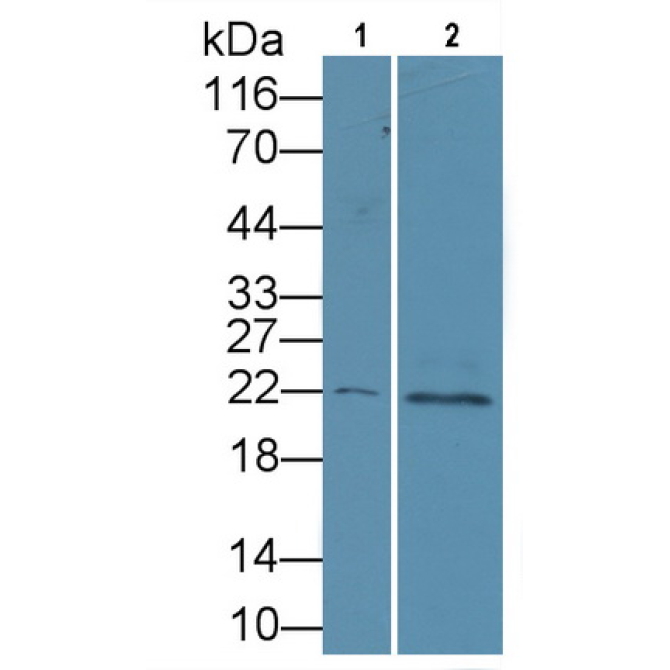 Parathyroid Hormone Related Protein (PTHrP) Mouse Polyclonal Antibody