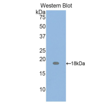 Parathyroid Hormone Related Protein (PTHrP) Mouse Polyclonal Antibody