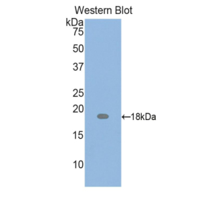 Parathyroid Hormone Related Protein (PTHrP) Mouse Polyclonal Antibody