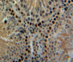 Parathyroid Hormone Related Protein (PTHrP) Rat Polyclonal Antibody