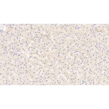 Coagulation Factor II (F2) Human Polyclonal Antibody