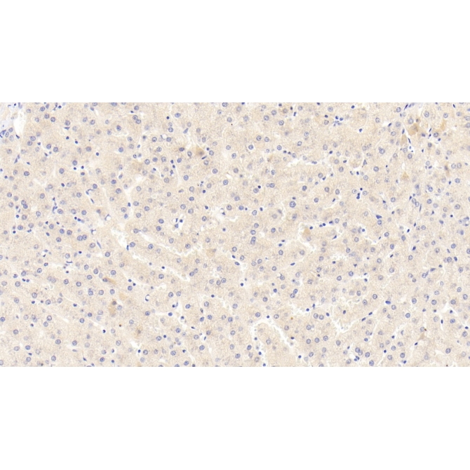 Coagulation Factor II (F2) Human Polyclonal Antibody