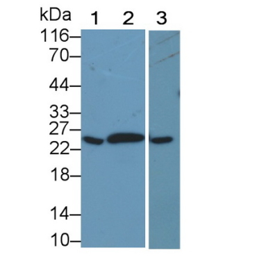 C Reactive Protein (CRP) Equus caballus, Equine (Horse) Polyclonal Antibody