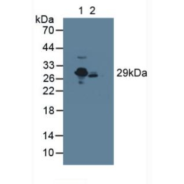 C Reactive Protein (CRP) Human Polyclonal Antibody
