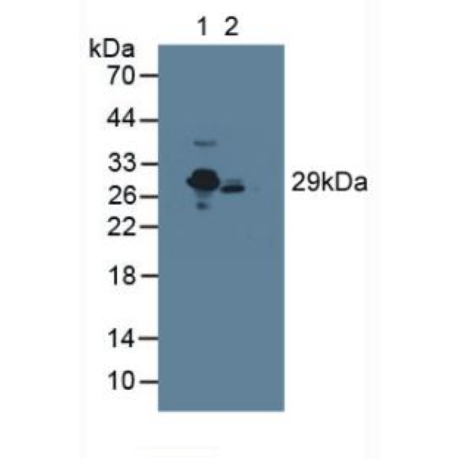 C Reactive Protein (CRP) Human Polyclonal Antibody