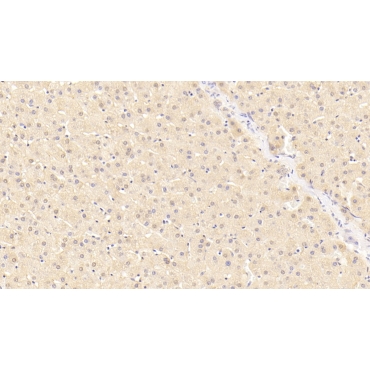 C Reactive Protein (CRP) Human Polyclonal Antibody