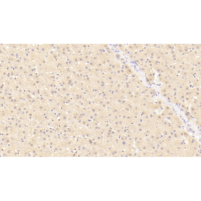 C Reactive Protein (CRP) Human Polyclonal Antibody