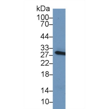 C Reactive Protein (CRP) Mouse Polyclonal Antibody