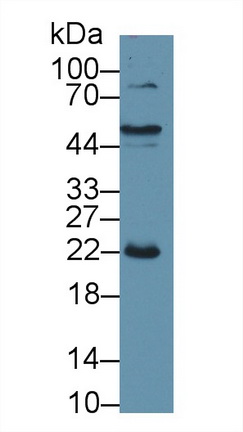 C Reactive Protein (CRP) Pig Polyclonal Antibody