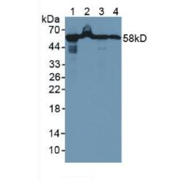 Heat Shock Protein 60 (Hsp60) Human Polyclonal Antibody