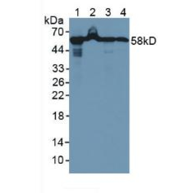 Heat Shock Protein 60 (Hsp60) Human Polyclonal Antibody