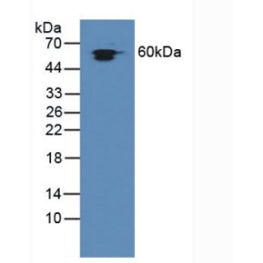 Heat Shock Protein 60 (Hsp60) Human Polyclonal Antibody