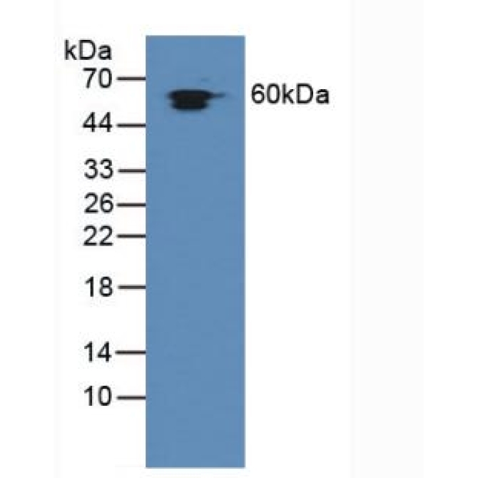 Heat Shock Protein 60 (Hsp60) Human Polyclonal Antibody