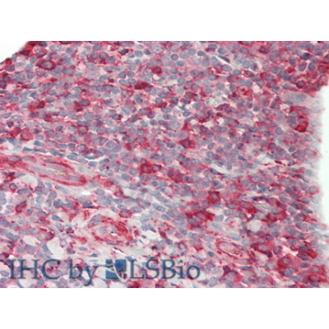 Cluster Of Differentiation 86 (CD86) Human Polyclonal Antibody