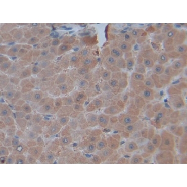 Tumor Necrosis Factor Ligand Superfamily, Member 14 (TNFSF14) Human Polyclonal Antibody