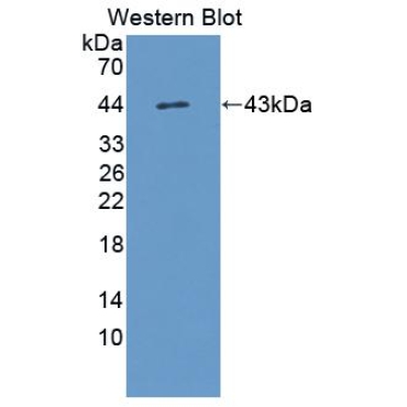 Follicle Stimulating Hormone (FSH) Human Polyclonal Antibody