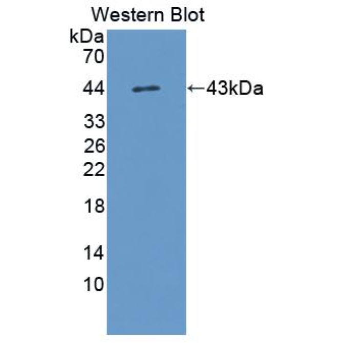 Follicle Stimulating Hormone (FSH) Human Polyclonal Antibody