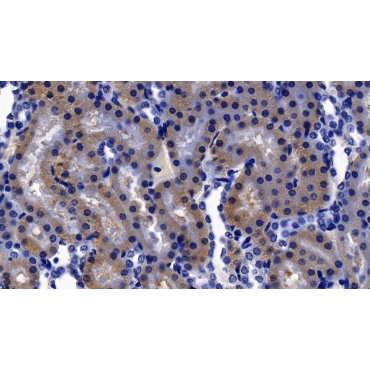 Corticotropin Releasing Factor (CRF) Human Polyclonal Antibody