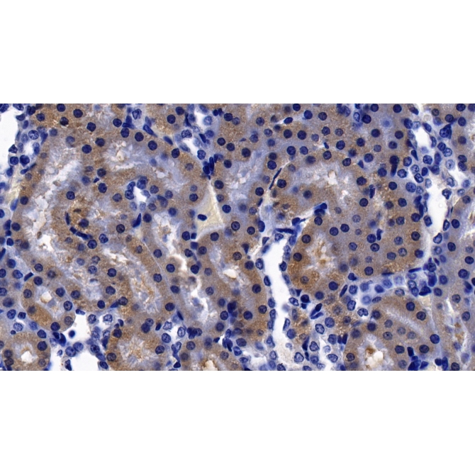 Corticotropin Releasing Factor (CRF) Human Polyclonal Antibody