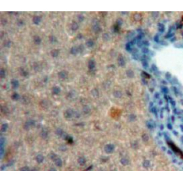 Corticotropin Releasing Factor (CRF) Human Polyclonal Antibody