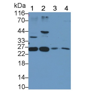 Corticotropin Releasing Factor (CRF) Human Polyclonal Antibody