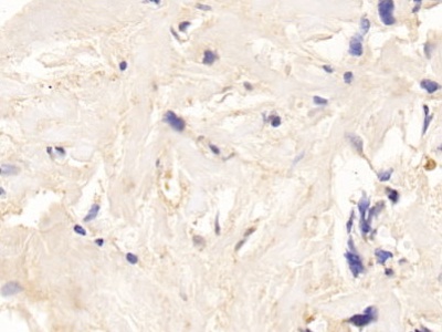 Adrenocorticotropic Hormone (ACTH) Pan-species (General) Polyclonal Antibody