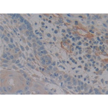 Nitric Oxide Synthase 2, Inducible (NOS2) Human Polyclonal Antibody